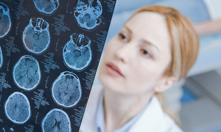 Doctor examining brain MRI scans
